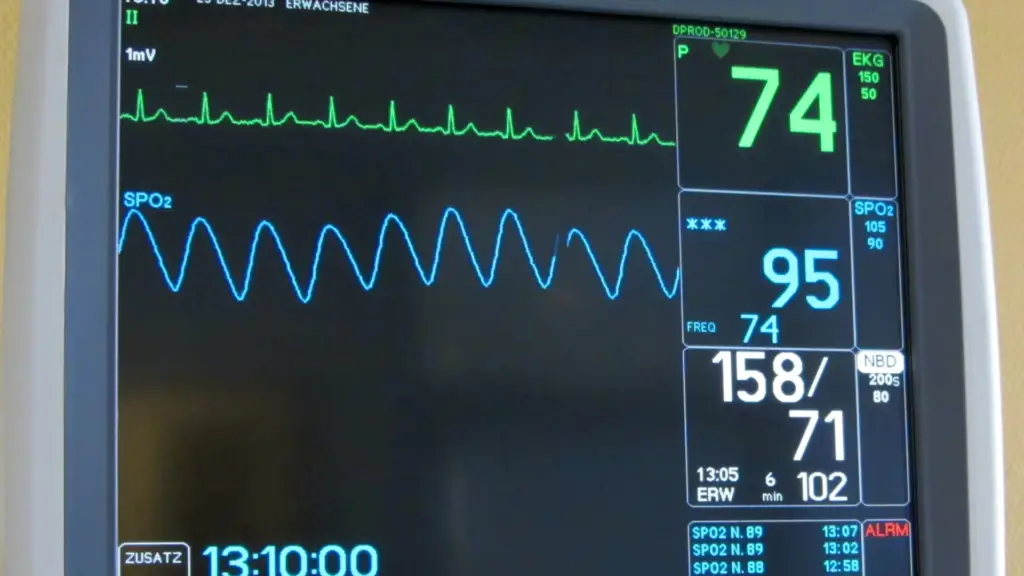 Screen of a medical monitor device.